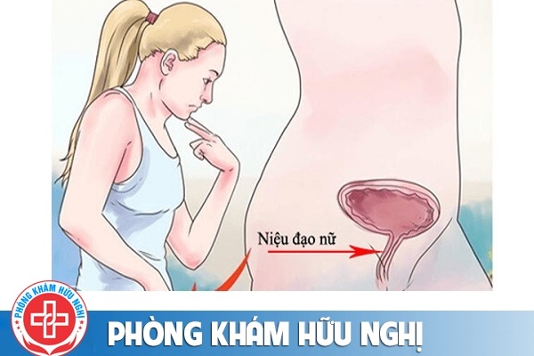 Viêm niệu đạo nữ và những điều cần biết