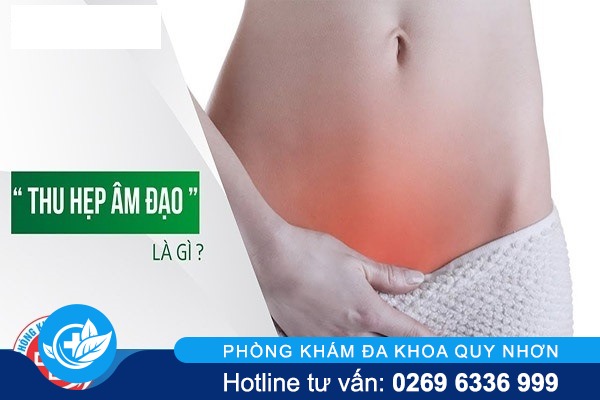 Những điều cần biết về thủ thuật thu hẹp âm đạo