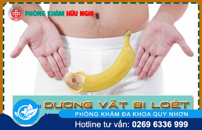 Dấu hiệu dương vật bị loét nguyên nhân và hỗ trợ điều trị