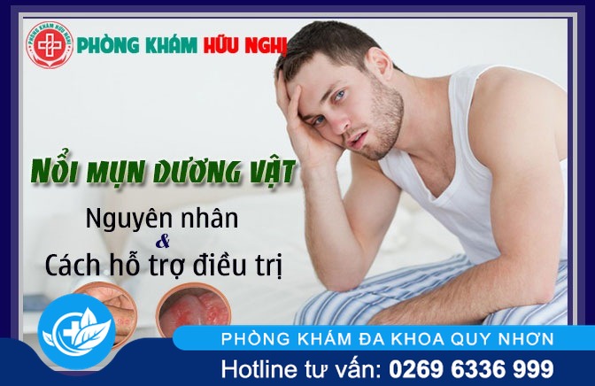 Nổi mụn ở dương vật nguyên nhân và cách hỗ trợ điều trị