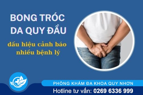 Tróc da quy đầu phải làm sao để chữa trị?