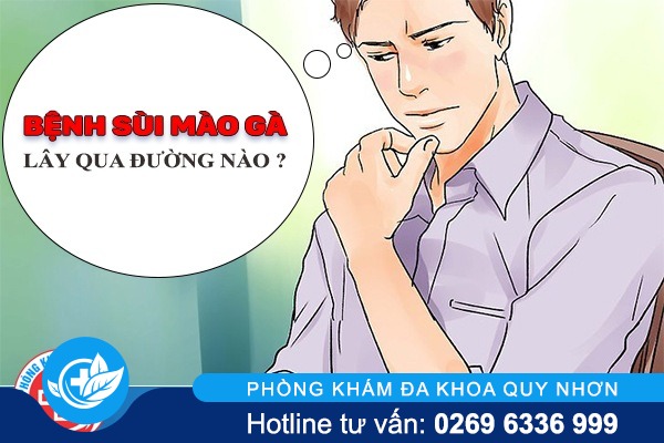 Ngoài lây nhiễm qua đường tình dục bệnh sùi mào gà lây qua đường nào ?