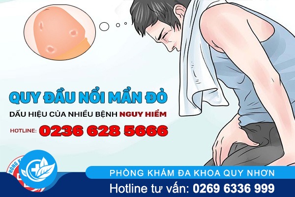 Quy đầu nổi mẩn đỏ dấu hiệu của nhiều bệnh nguy hiểm.