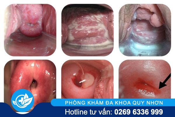 dau-bung-duoi-o-nu-gioi-canh-bao-dieu-gi (2)