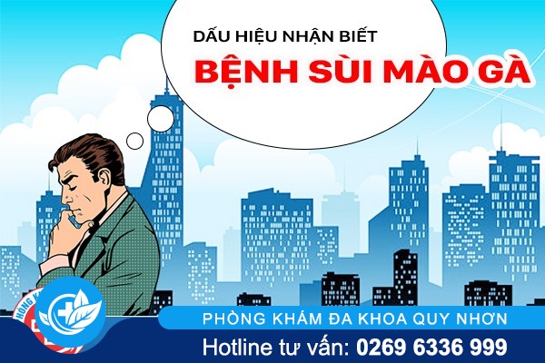 Điều trị sùi mào gà hiệu quả và hạn chế tái phát .