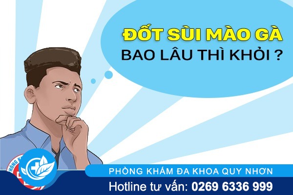 Đốt sùi mào gà bao lâu thì khỏi và có hiệu quả không ?