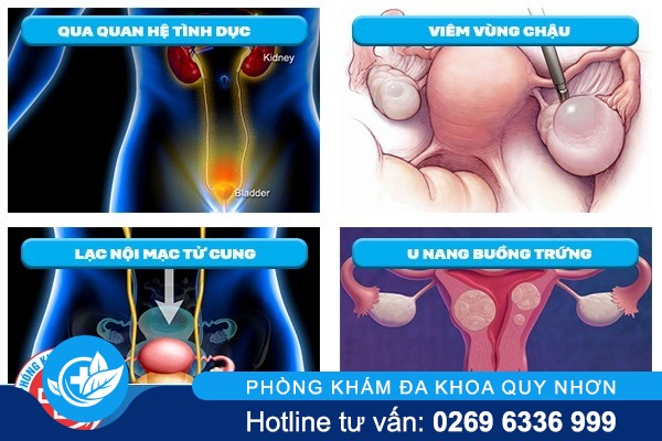 điều trị đau bụng dưới