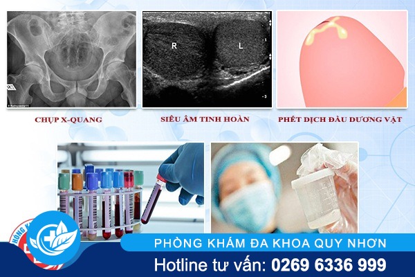 xét nghiệm nam khoa tại Quy Nhơn 