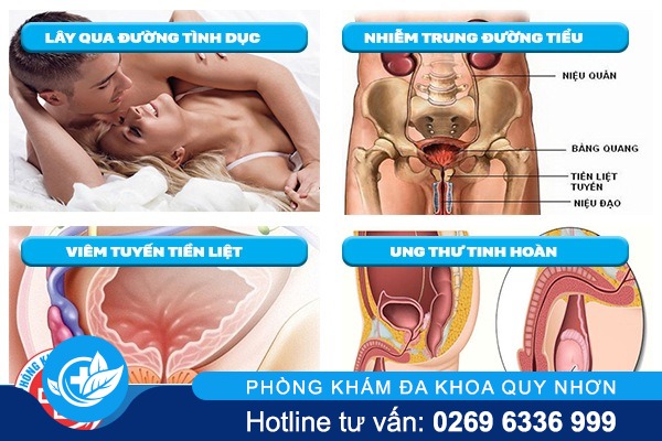 điều trị đau bụng dưới