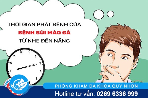 Thời gian phát bệnh sùi mào gà từ nhẹ đến nặng