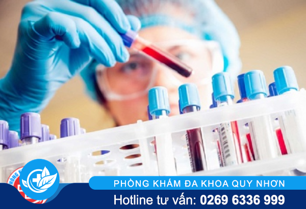 Xét nghiệm bệnh xã hội ở đâu thì uy tín ?