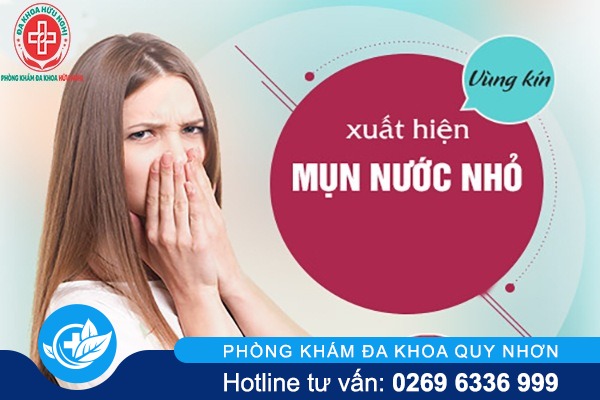 Mọc mụn ở vùng kín phải làm thế nào ?
