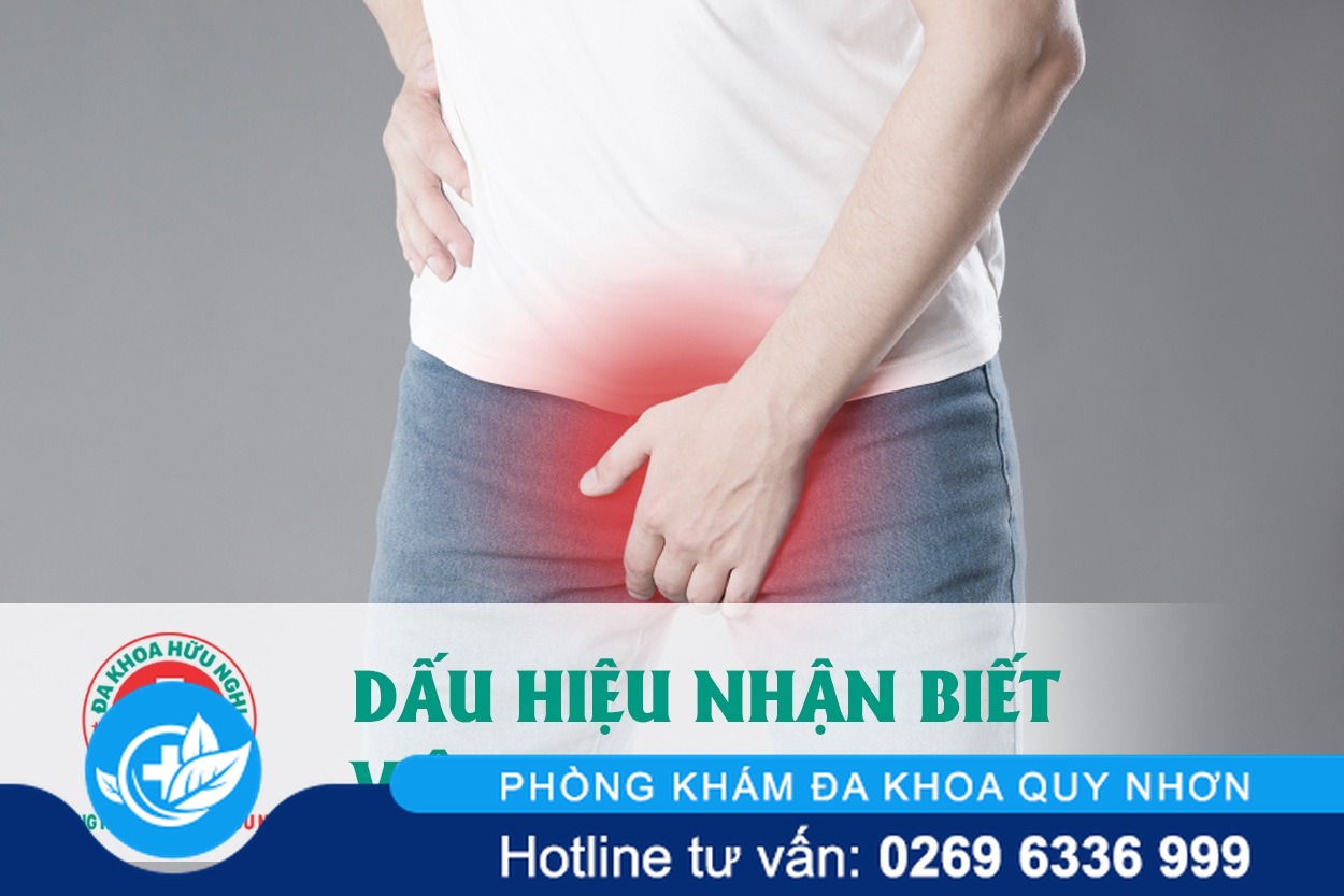 Một số bệnh viêm nam khoa nam giới thường hay gặp và dễ mắc phải