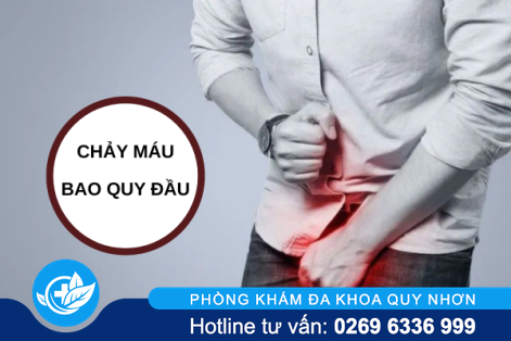 Chảy máu bao quy đầu là bị bệnh gì?