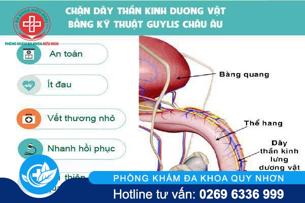 Phương pháp hỗ trợ chữa yếu sinh lý an toàn, hiệu quả