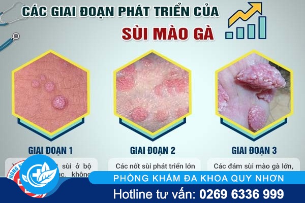 ho-tro-chua-sui-mao-ga-o-duong-vat-bang-cach-nao-hieu-qua-3