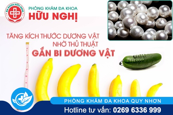 chi phí gắn bi dương vật