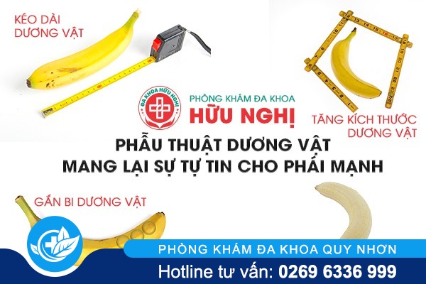 chi phí phẫu thuật dương vật