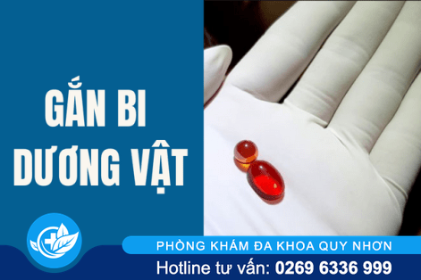 Gắn bi dương vật ở đâu an toàn?