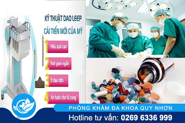 Điều trị viêm loét tử cung như thế nào hiệu quả?