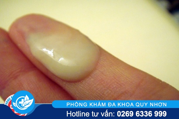 khi-hu-mau-nau-vang-do-dau