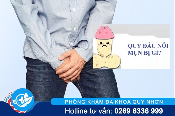 Quy đầu nổi mụn là bị bệnh gì có nguy hiểm không?