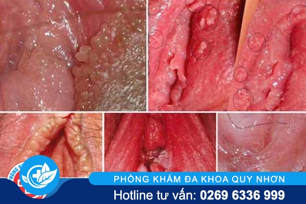 44625192-1569048745973