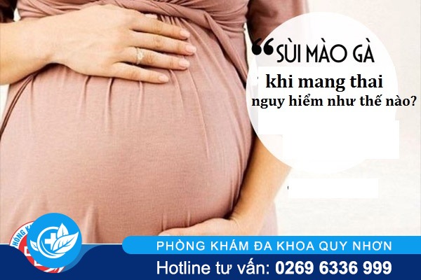 Sùi mào gà khi mang thai nguy hiểm như thế nào?