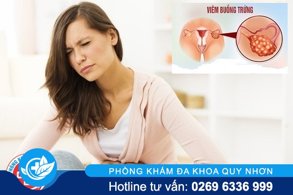 Viêm buồng trứng là gì có nguy hiểm không?