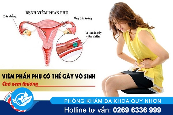 Chữa viêm phần phụ ở đâu hiệu quả?