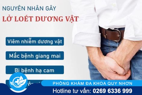 Địa chỉ khám dương vật uy tín tại Quy Nhơn