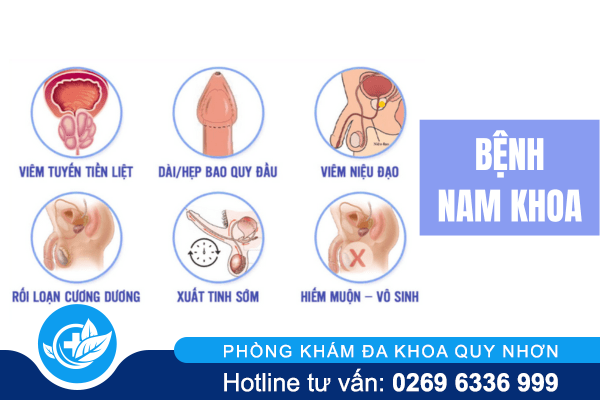 phong-kham-chuyen-kham-chua-benh-duong-vat-hieu-qua-01