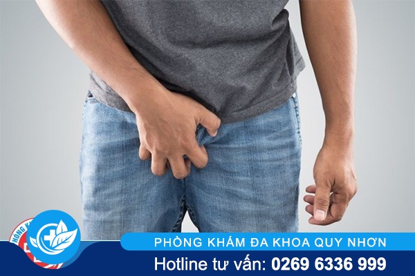 Tinh hoàn ứ nước là bị bệnh gì?