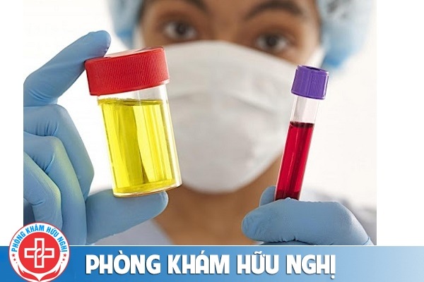 Nước tiểu màu đỏ là bị bệnh gì và cách chữa trị