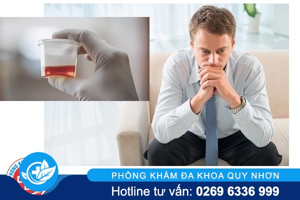 Tiểu ra máu ở nam nguyên nhân và cách điều trị