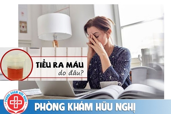Tiểu ra máu ở nữ là bị gì có nguy hiểm không?