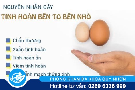 Tinh hoàn bên to bên nhỏ là bị bệnh gì nguy hiểm không?