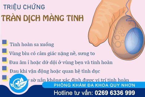 Tràn dịch màng tinh hoàn triệu chứng và cách điều trị