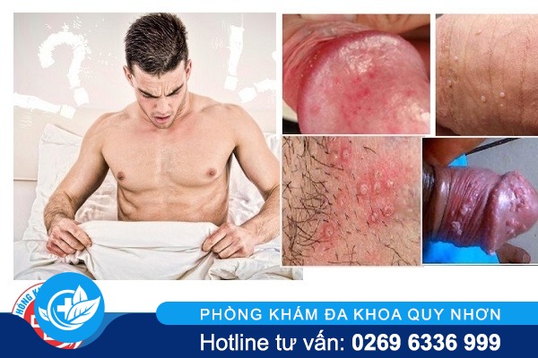 vung-kin-nam-noi-man-do