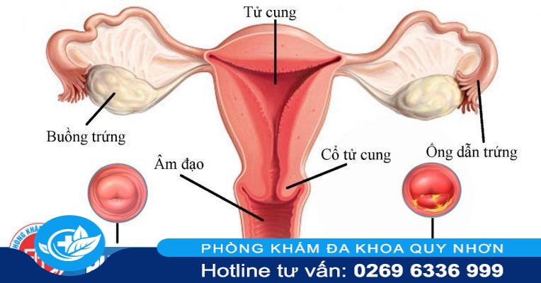 20190330-164827-107846-hinh-anh-viem-lo-tu.max-1800x1800