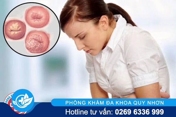 Phương pháp nào điều trị viêm lộ tuyến cổ tử cung hiệu quả?