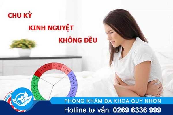 Thế nào được xem là kinh nguyệt không đều ?