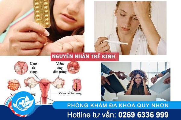 Trễ kinh là triệu chứng của bệnh gì?