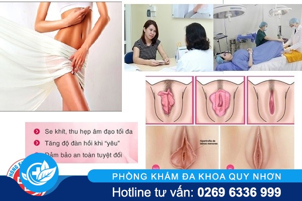 phong-kham-thu-hep-am-dao