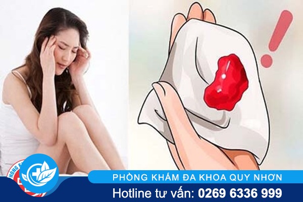 Tại sao quan hệ ra máu ?