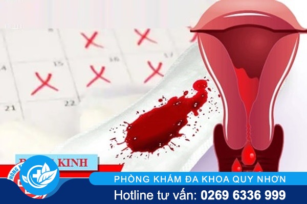 Phương pháp hỗ trợ cách chữa bệnh rong kinh ở nữ giới