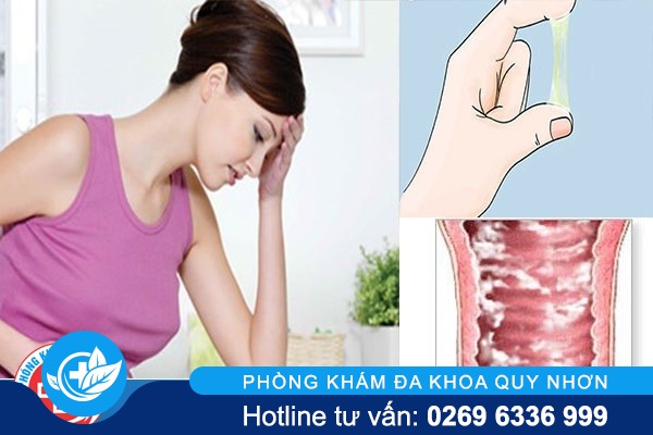 Tại sao lại bị viêm âm đạo – hậu quả của viêm âm đạo