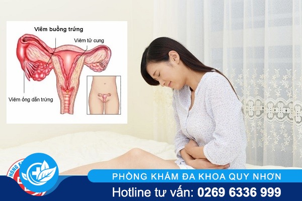 Thế nào là bệnh viêm buồng trứng?