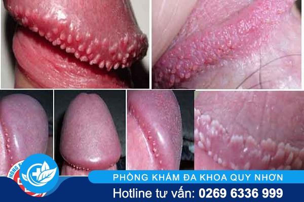 chuoi-hat-ngoc-duong-vat-la-gi