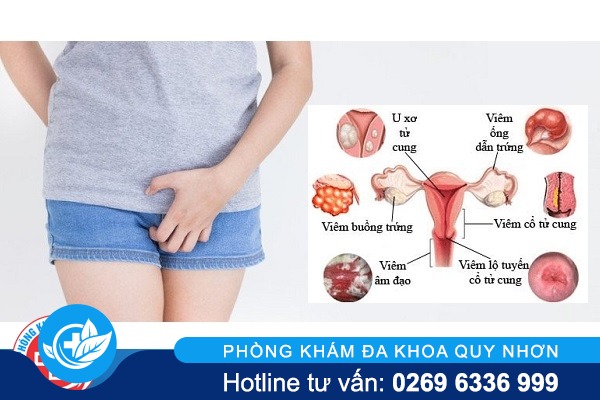 cac-trieu-chung-benh-phu-khoa